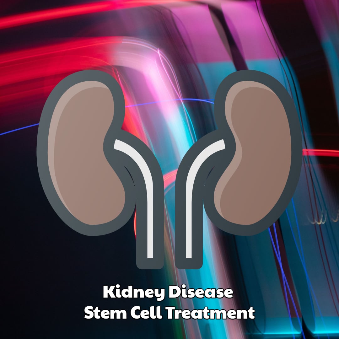 Kidney Disease Stem Cell Treatment Dream Body Clinic