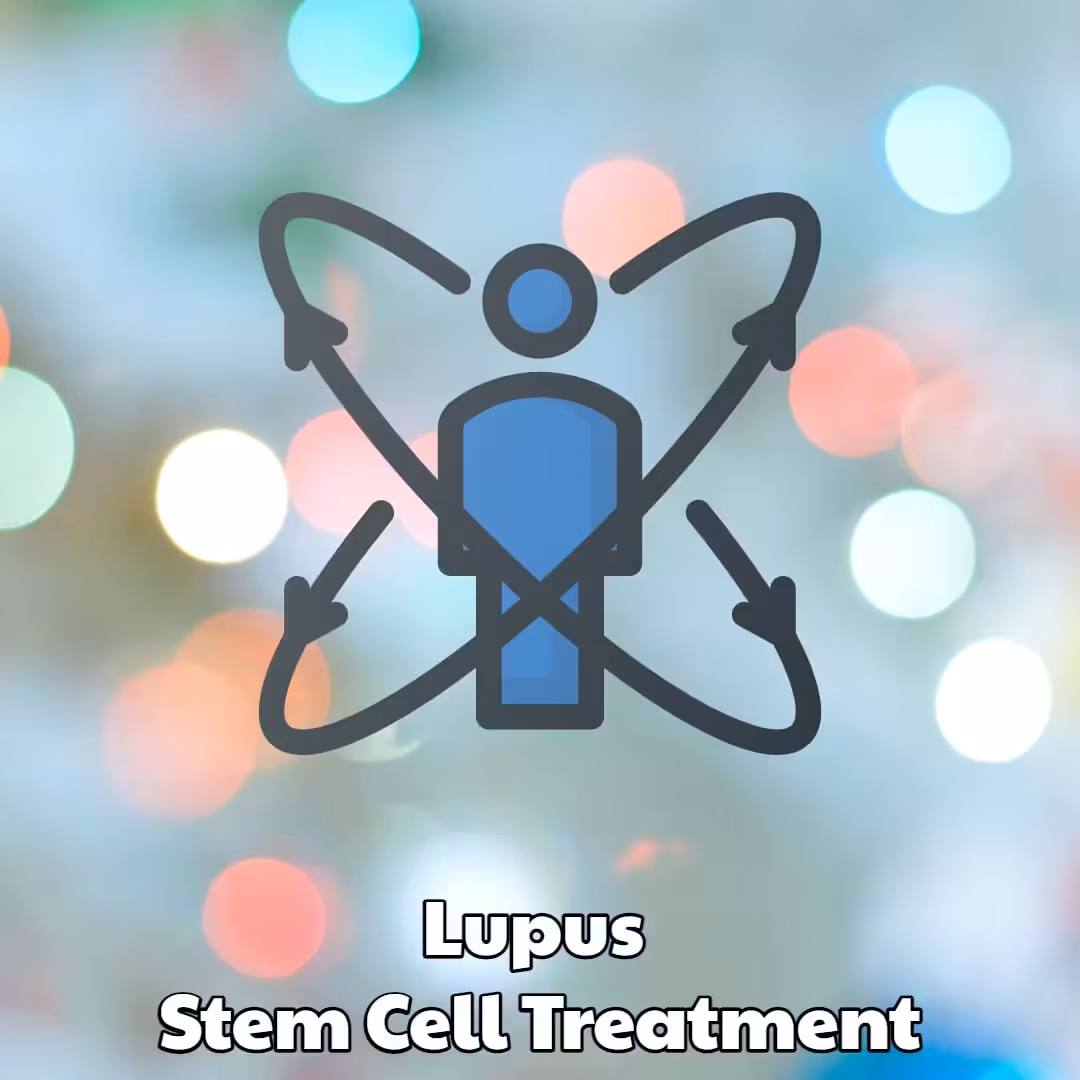 Lupus Stem Cell Treatment Dream Body Clinic