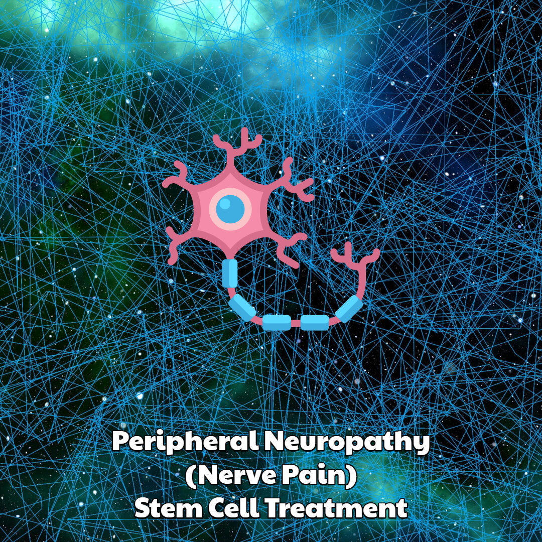 Peripheral Neuropathy Stem Cell Treatment Dream Body Clinic