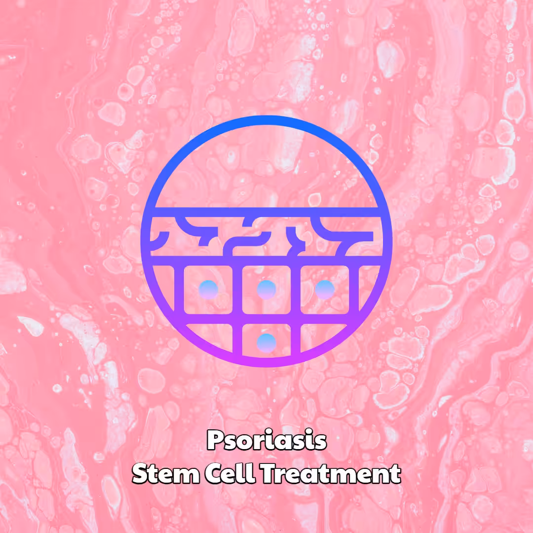 Psoriasis Stem Cell Treatment at Dream Body Clinic