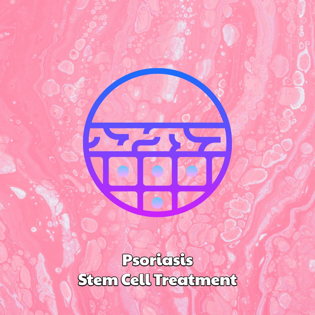 Psoriasis Stem Cell Treatment at Dream Body Clinic