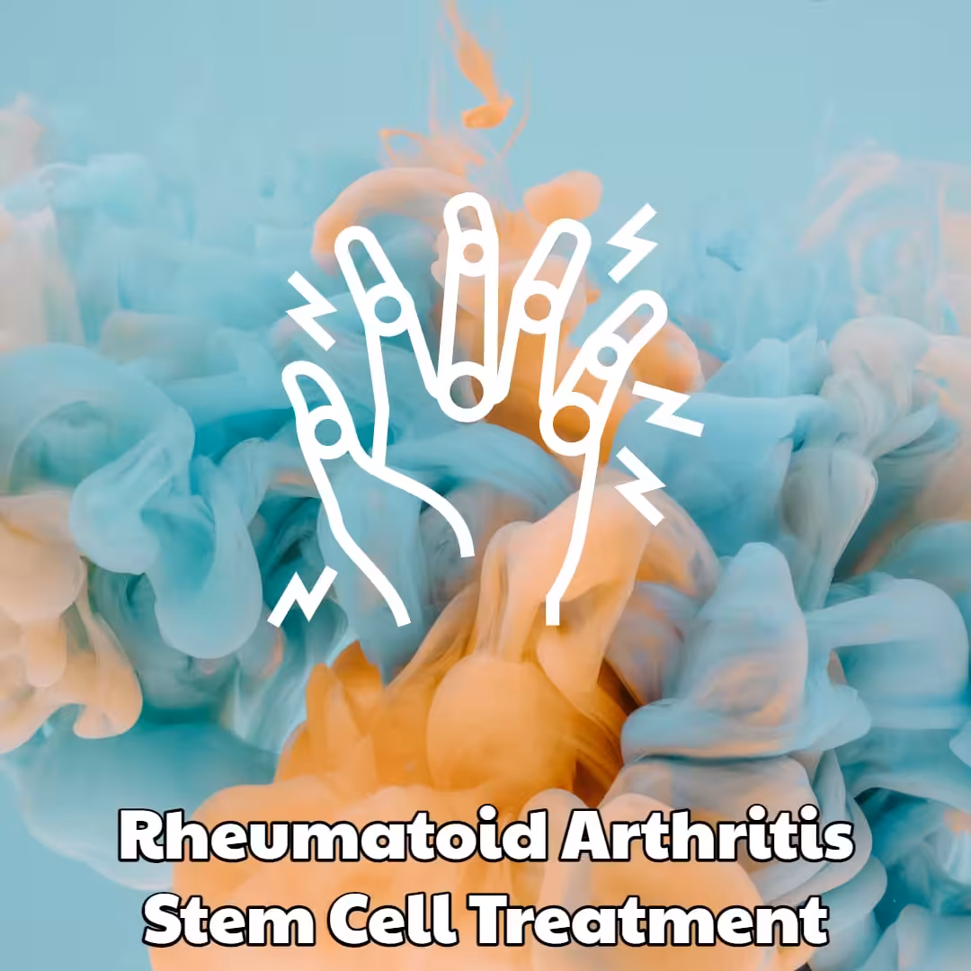 Rheumatoid Arthritis Stem Cell Treatment Dream Body Clinic