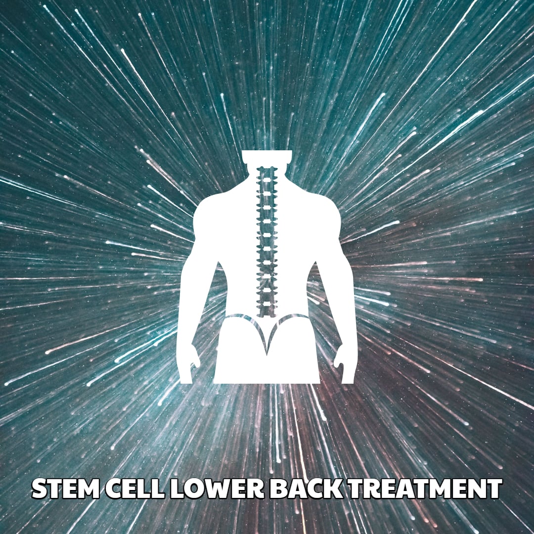lower back stem cell treatment