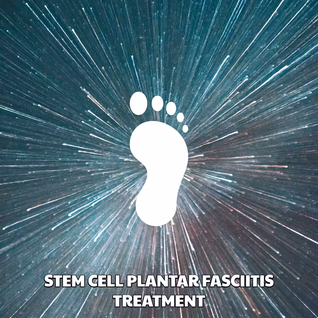Plantar Fasciitis Stem Cell Treatment
