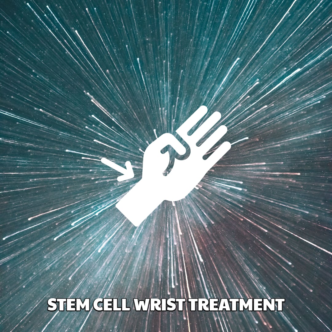 Stem Cell Wrist Treatment Dream Body Clinic