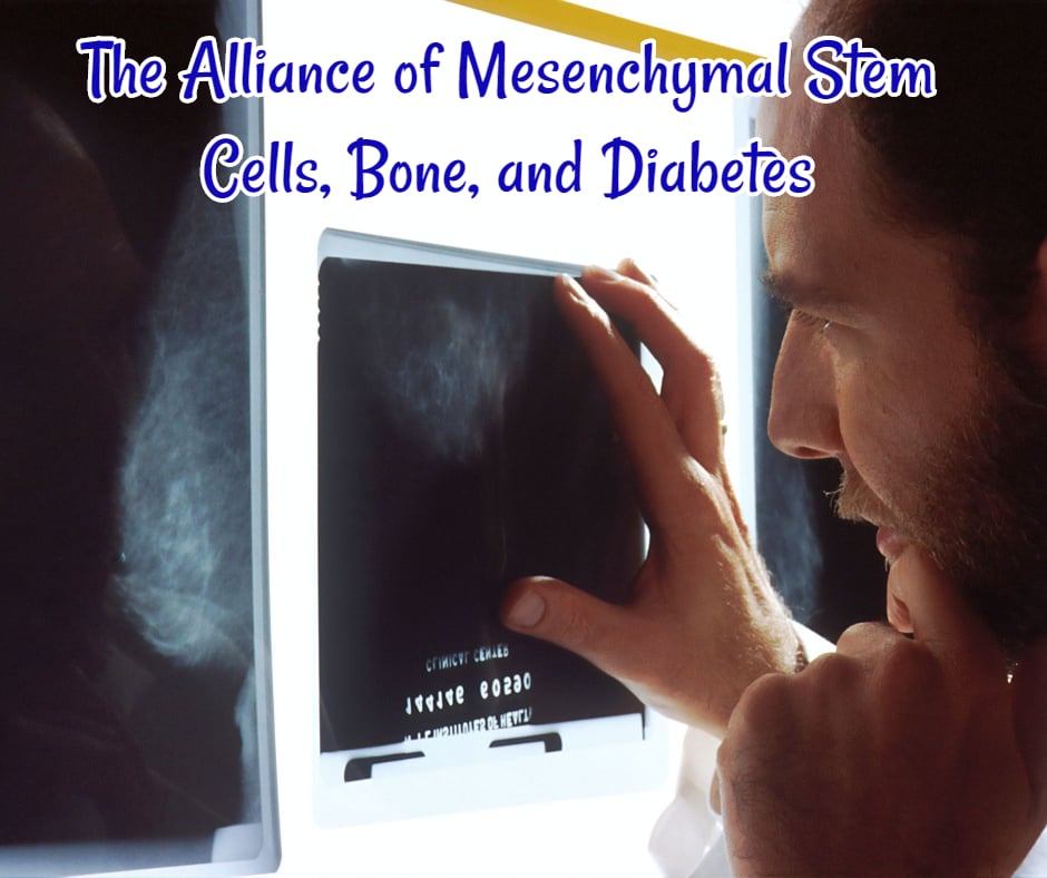 The Alliance of Mesenchymal Stem Cells Bone and Diabetes