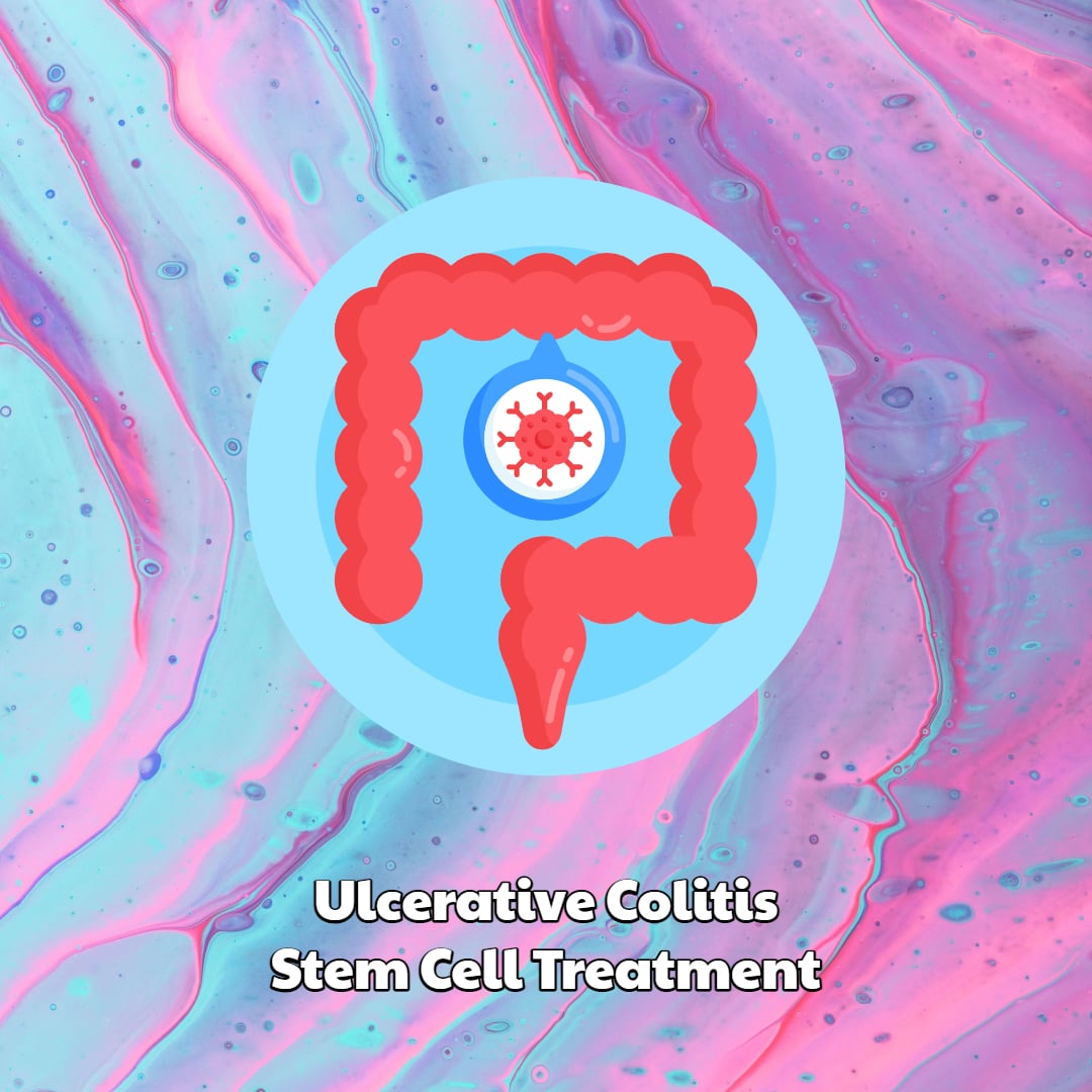Ulcerative Colitis Stem Cell Treatment Dream Body Clinic