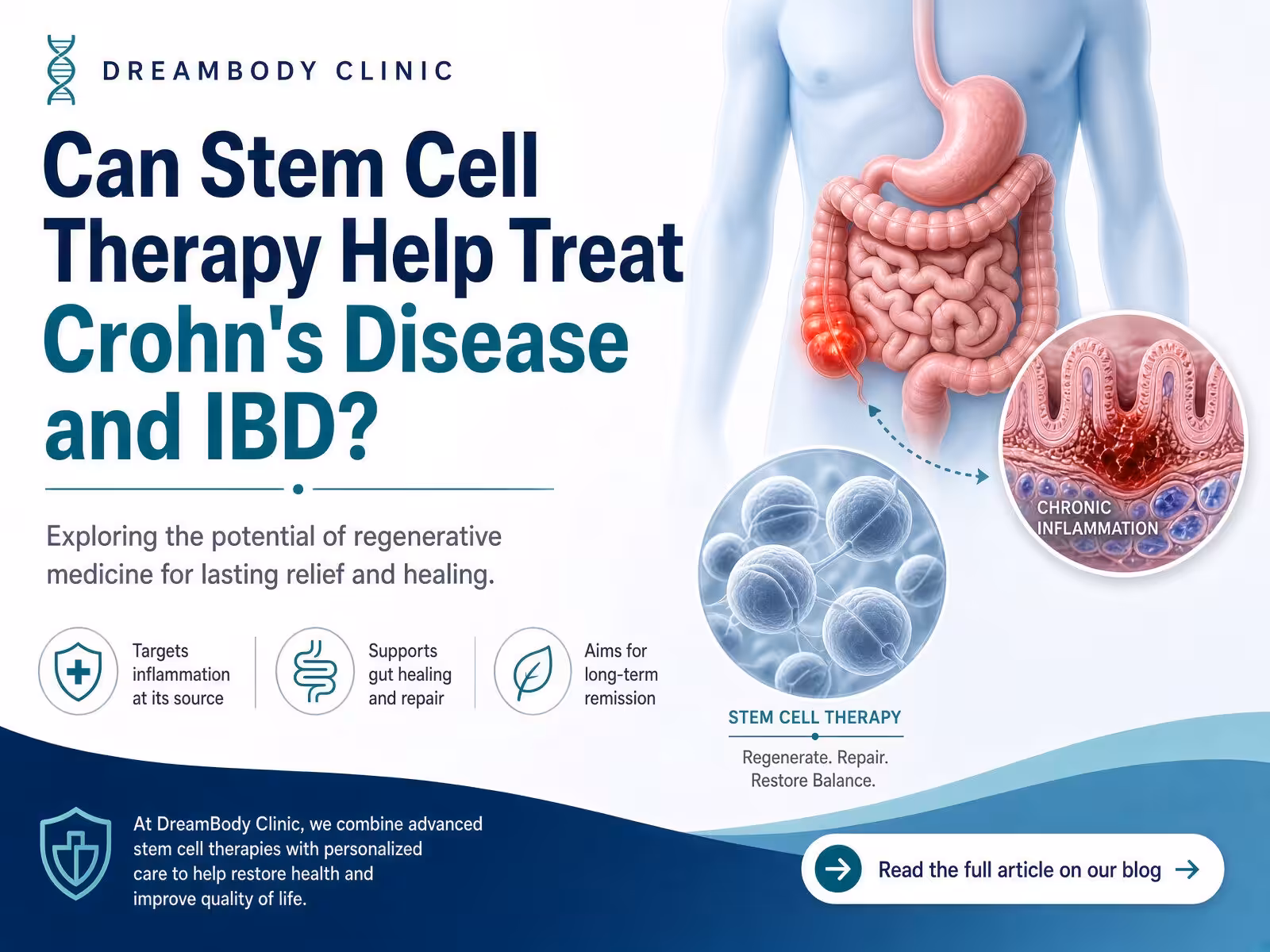 IBD Stem Cell Treatment