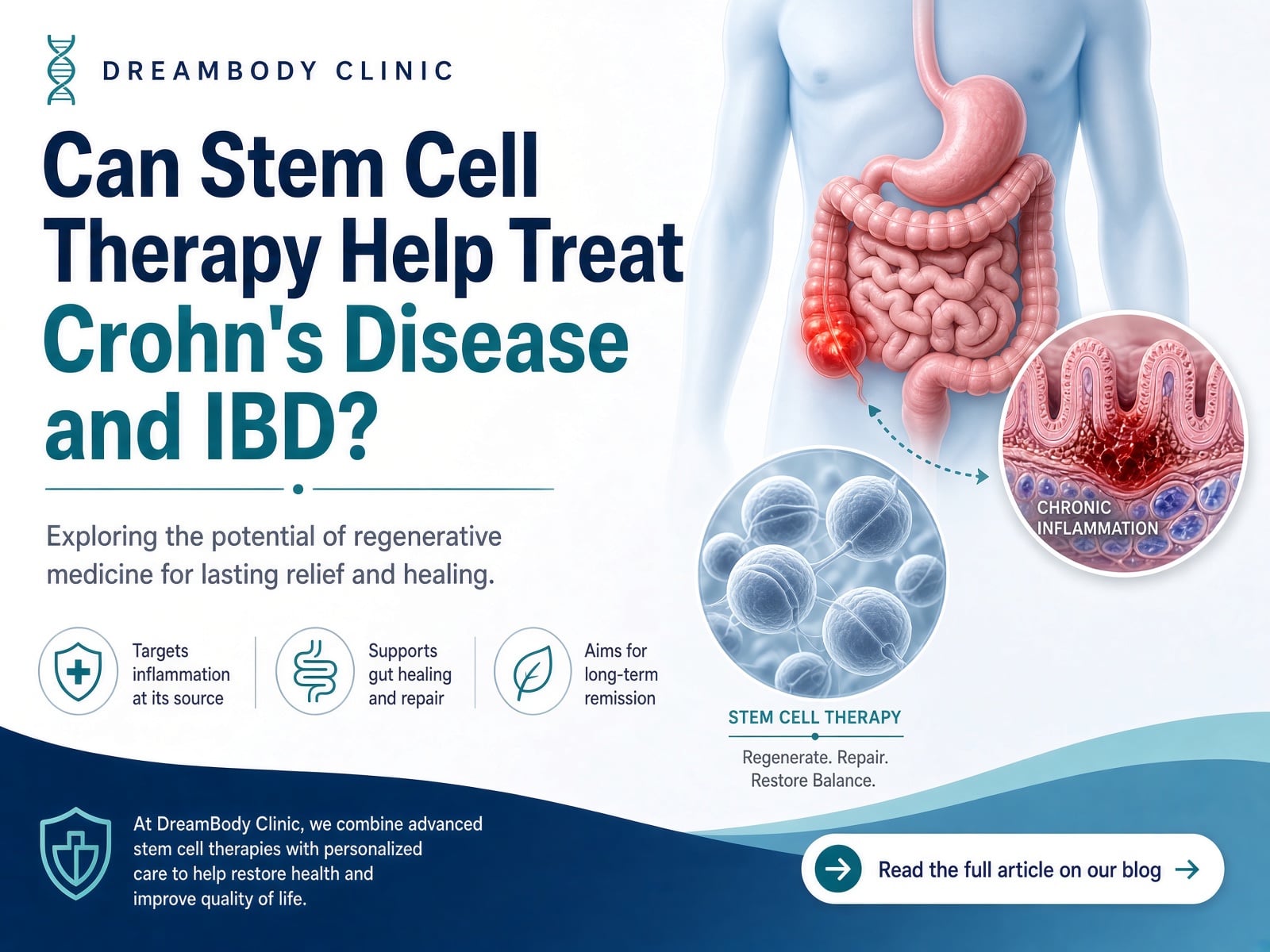 IBD Stem Cell Treatment