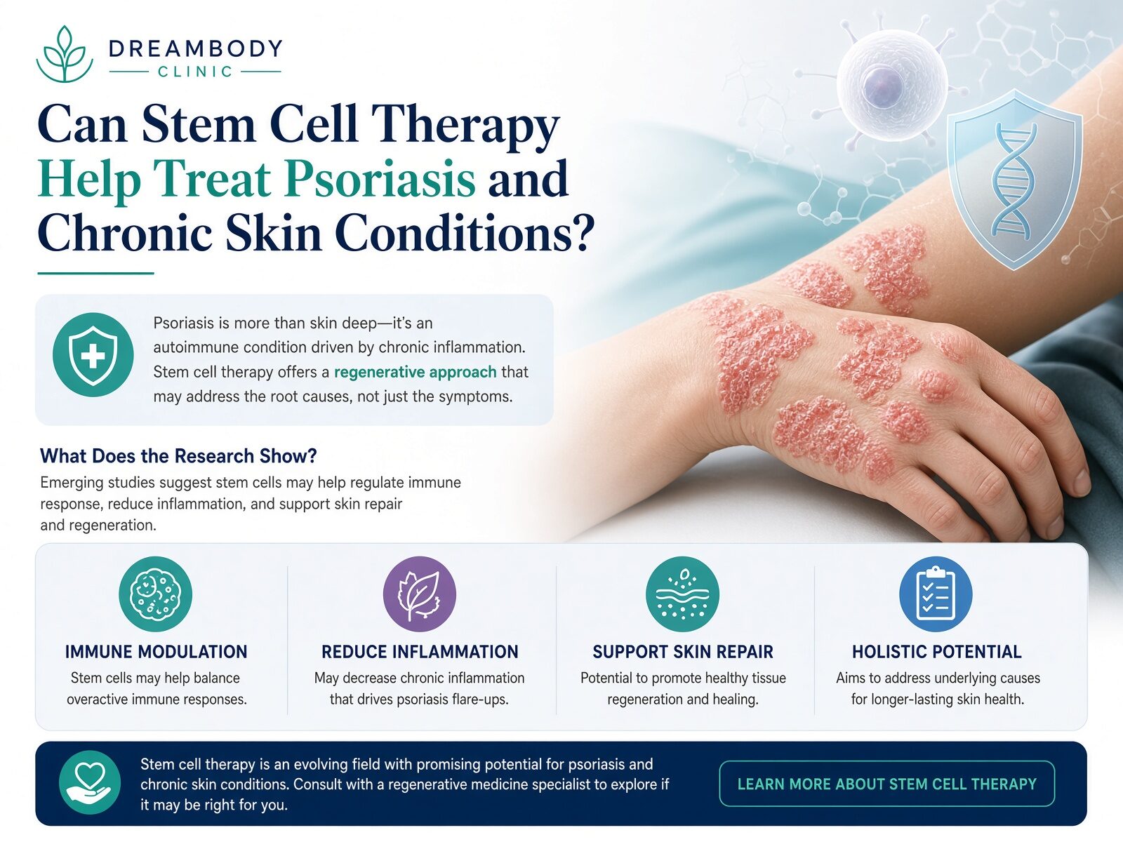 Heal Psoriasis with stem cell therapy