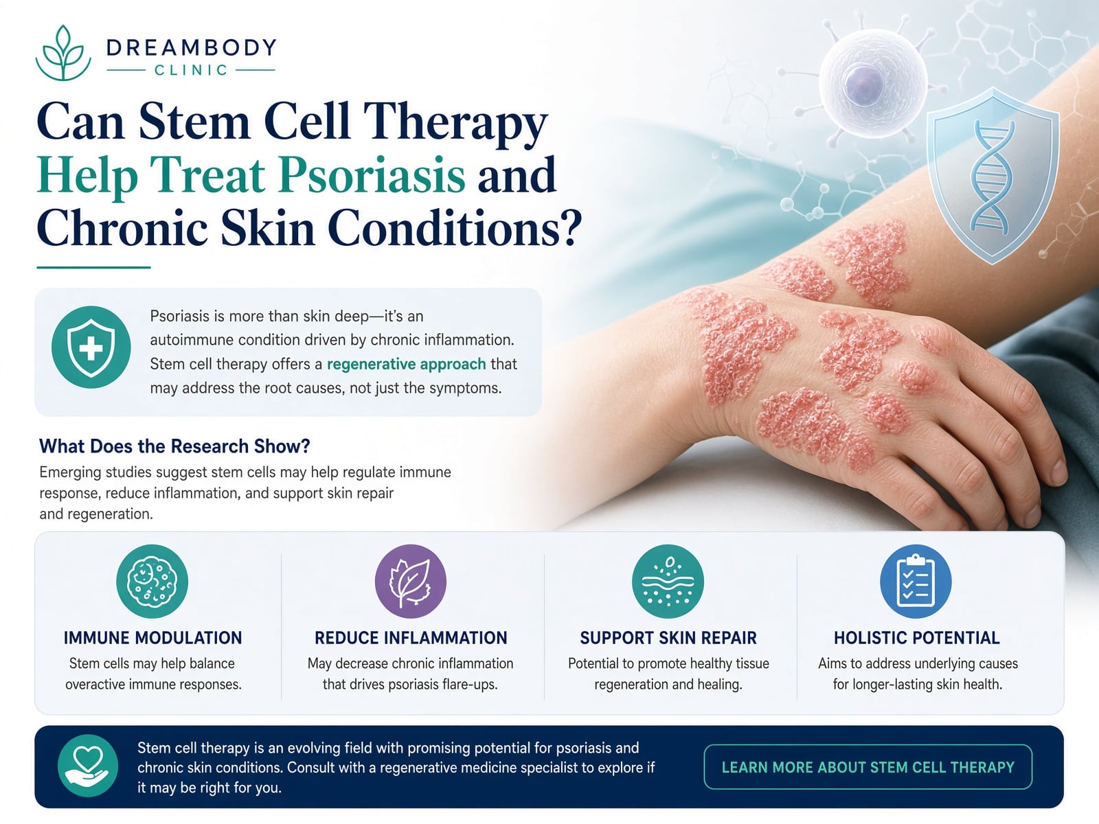 Heal Psoriasis with stem cell therapy