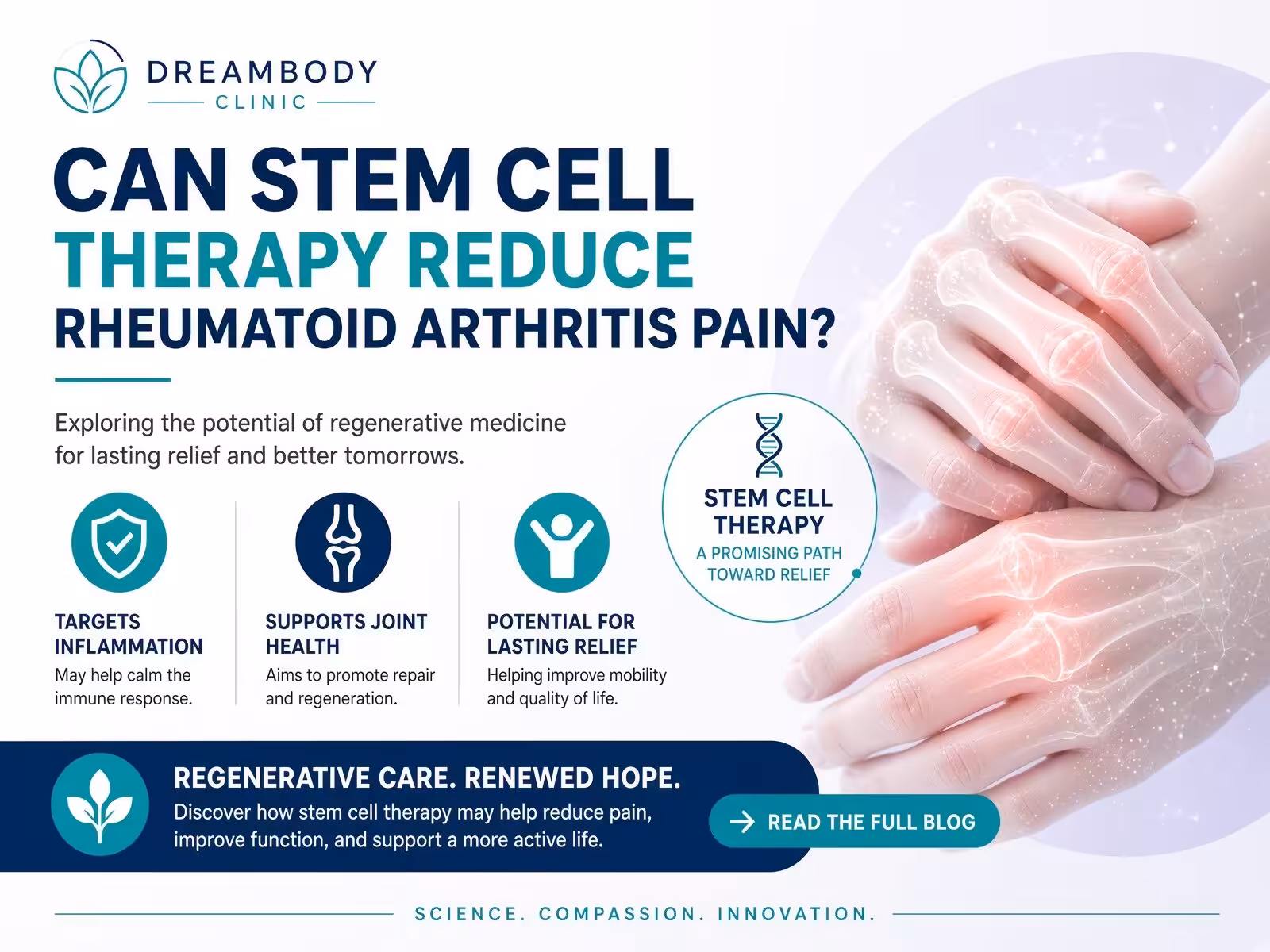 Rheumatoid Arthritis Stem Cell Treatment To Reduce Pain