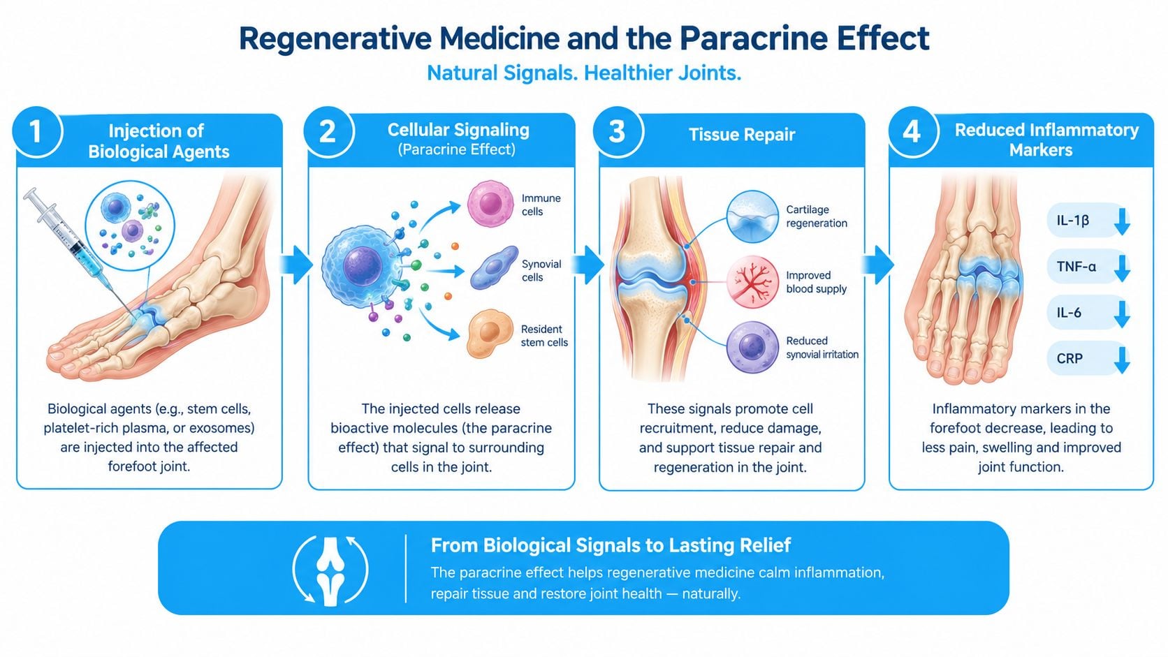 An infographic illustrating the four-step process of regenerative medicine for treating joint inflammation through the paracrine effect.