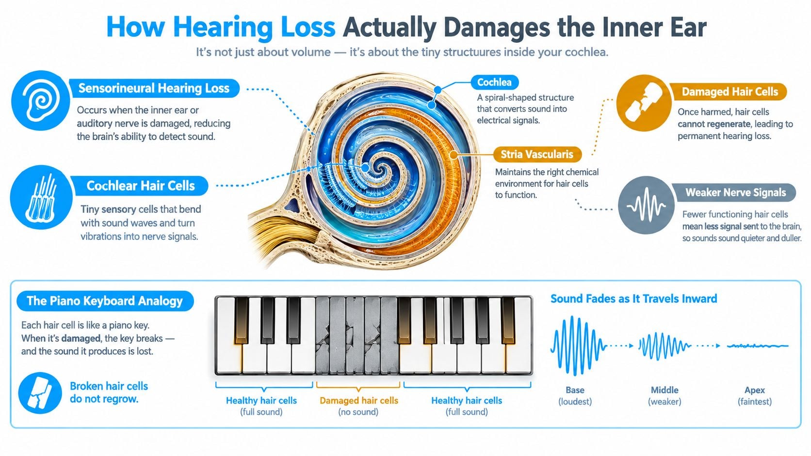 An infographic illustrating how sensorineural hearing loss damages the cochlea and hair cells using a piano analogy.