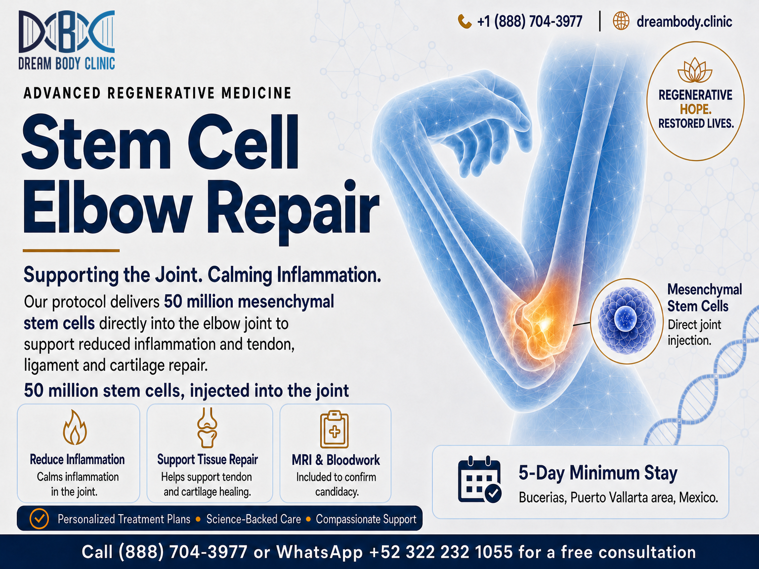 9 things to know elbow stem cell therapy