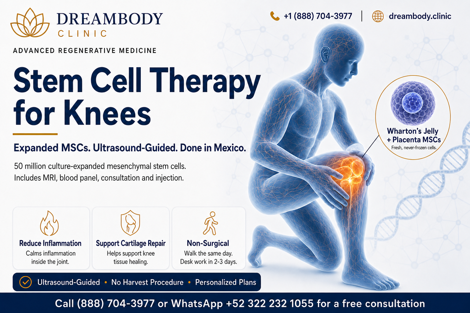 stem cell therapy for knees