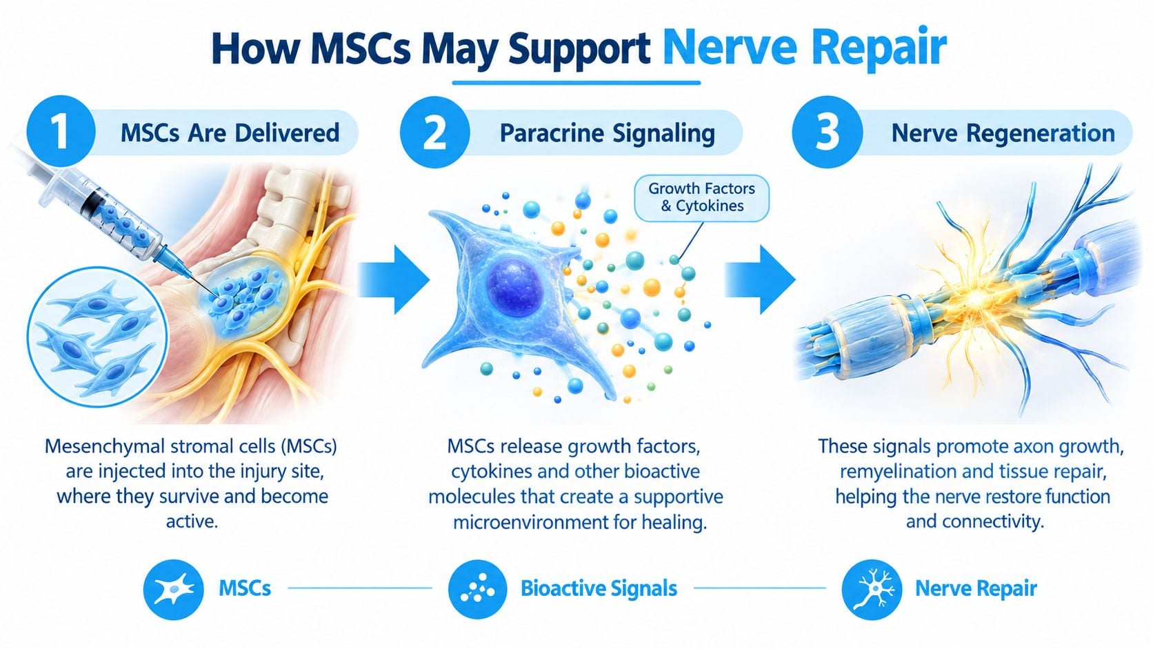 A three-step infographic showing how mesenchymal stromal cells support nerve repair through injection and paracrine signaling.