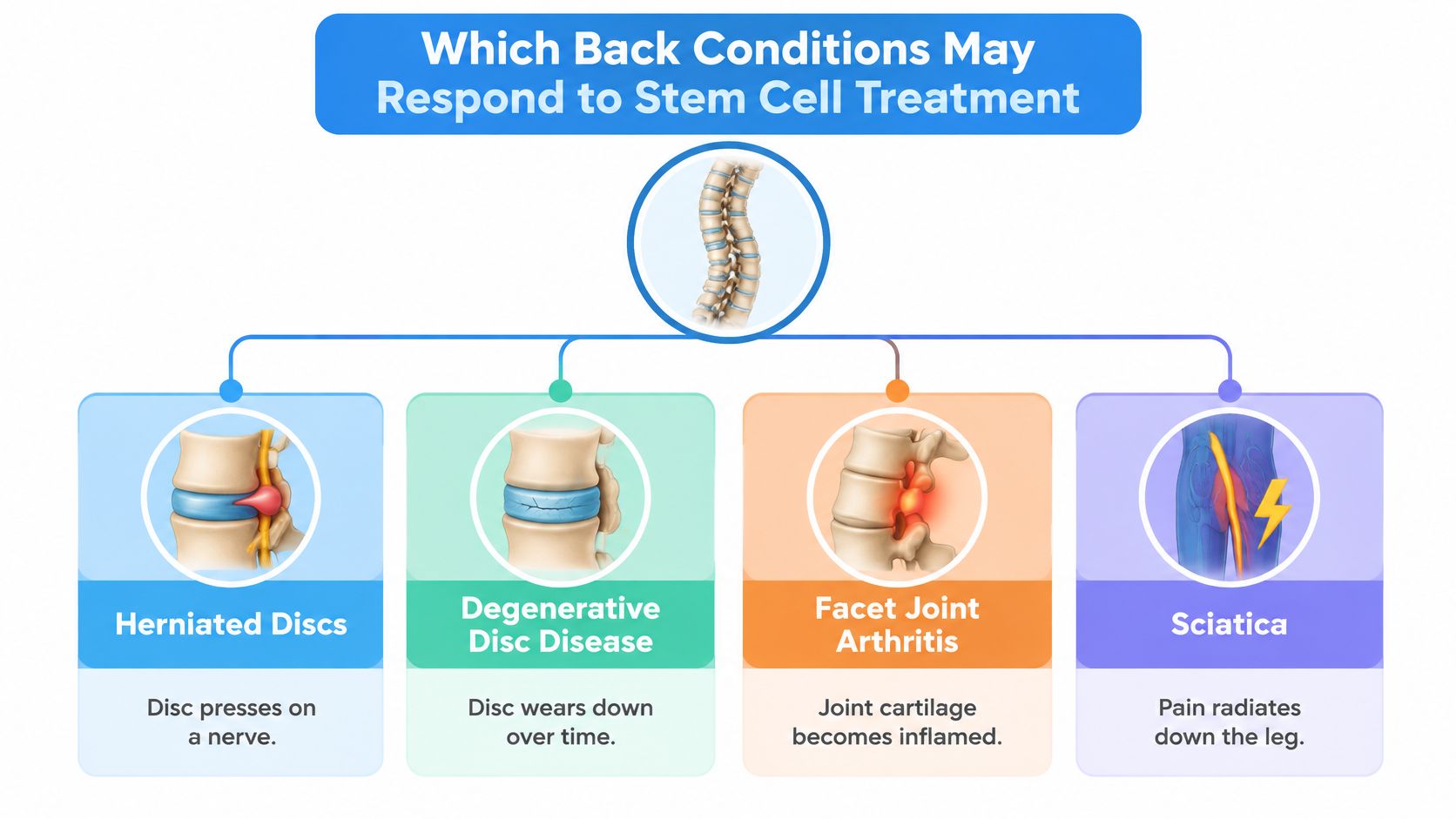 An educational infographic showing four common back conditions that may potentially be treated with stem cell therapy.