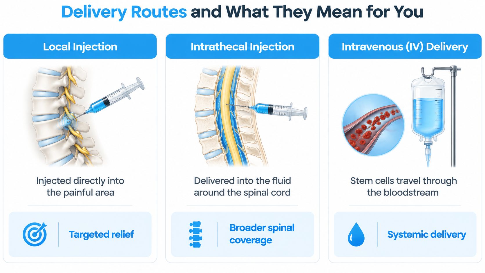 A diagram comparing three stem cell delivery methods: local injection, intrathecal injection, and intravenous delivery for back treatments.