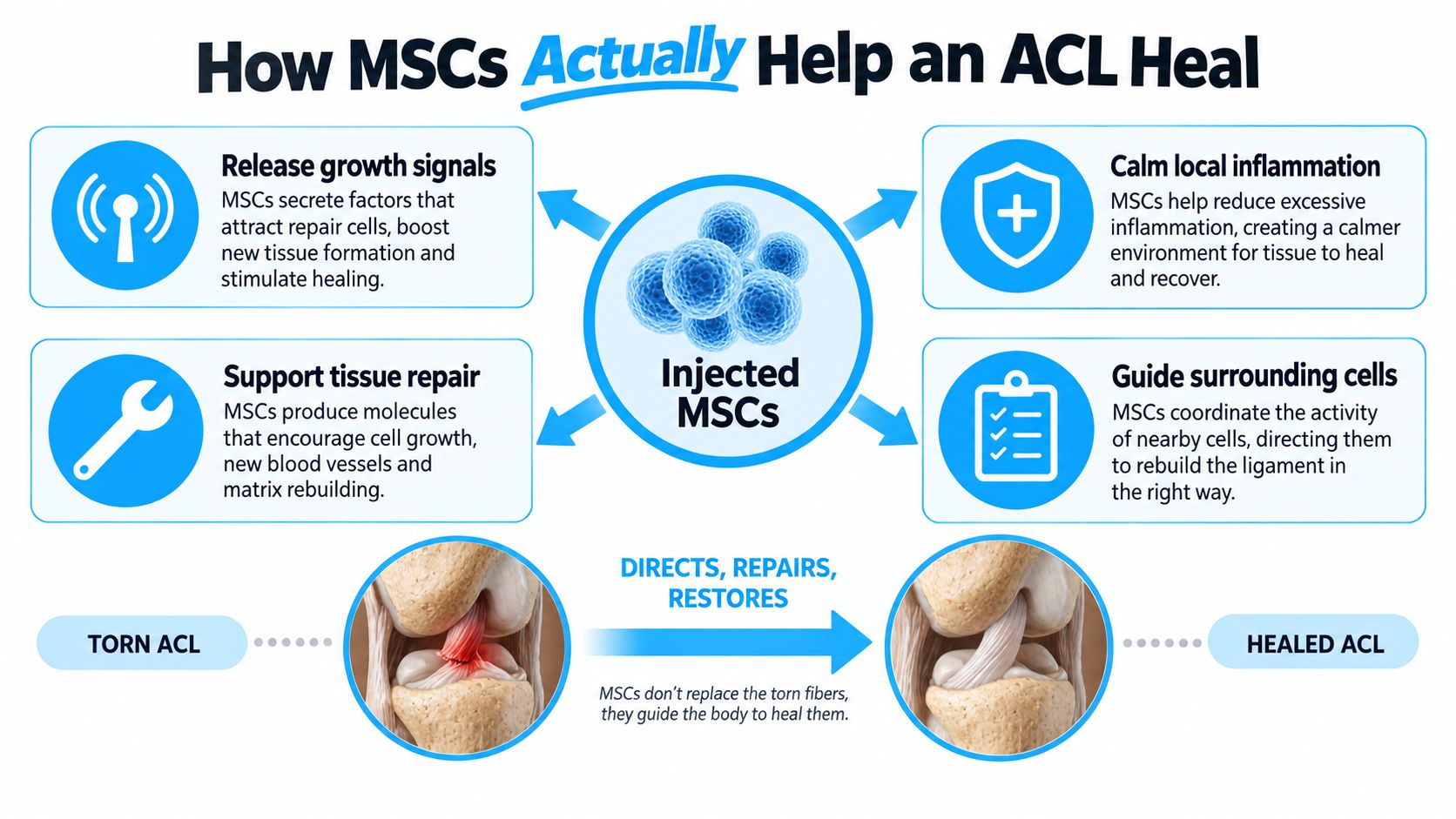 An infographic explaining how injected mesenchymal stem cells aid in the healing process of a torn ACL.